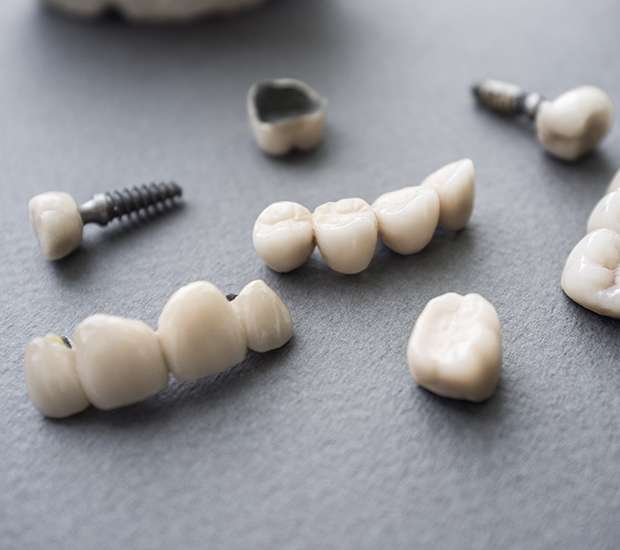 Bronx The Difference Between Dental Implants and Mini Dental Implants